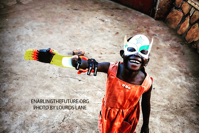 TECH LENDS A HAND WITH NEW LIMBS FOR KIDS AND ANIMALS